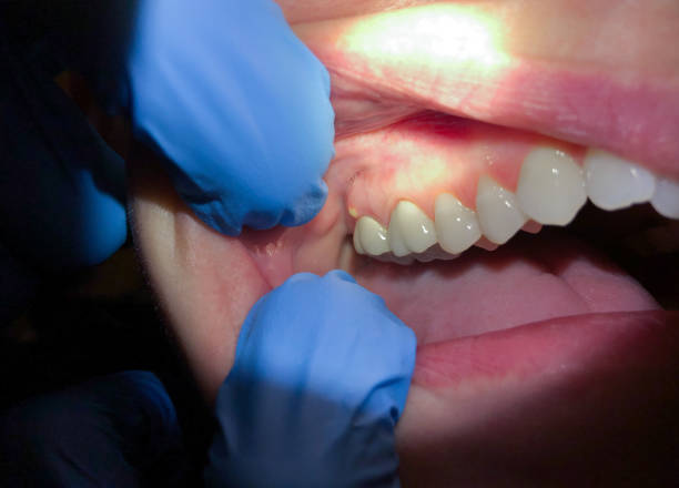 Best Pediatric Emergency Dentist in Germantown, WI